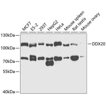 Western Blot - Anti-Gemin 3 Antibody (A14992) - Antibodies.com