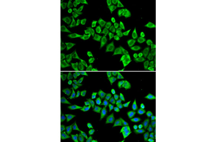 Immunofluorescence - Anti-Gemin 3 Antibody (A14992) - Antibodies.com