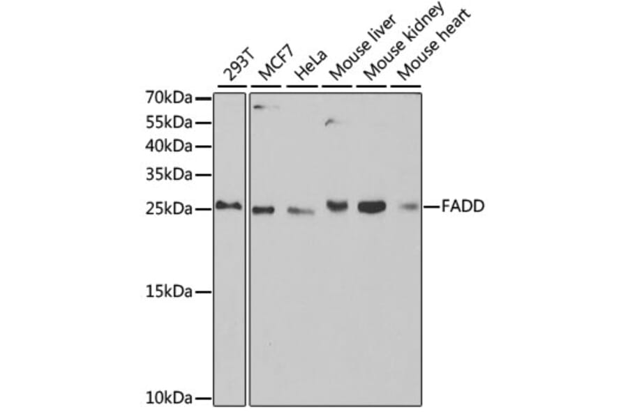 Western Blot - Anti-FADD Antibody (A14994) - Antibodies.com