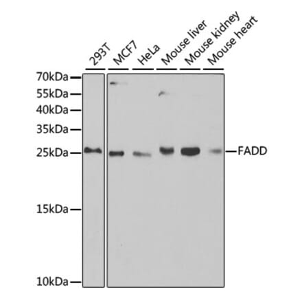 Western Blot - Anti-FADD Antibody (A14994) - Antibodies.com