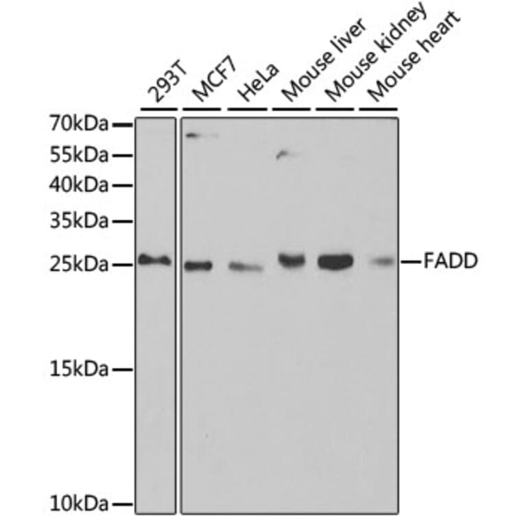 Western Blot - Anti-FADD Antibody (A14994) - Antibodies.com