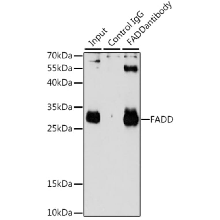 Western Blot - Anti-FADD Antibody (A14994) - Antibodies.com