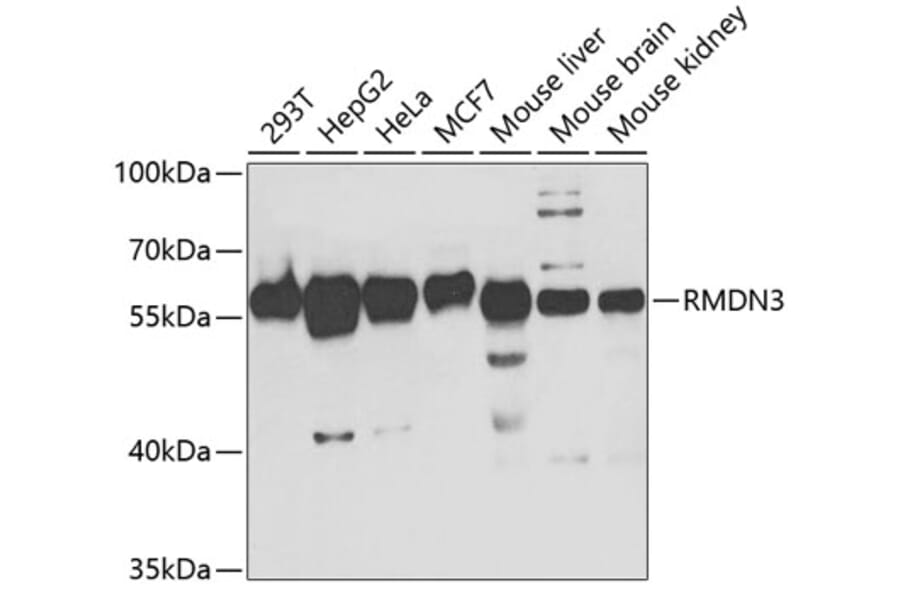 Western Blot - Anti-PTPIP51 Antibody (A14995) - Antibodies.com
