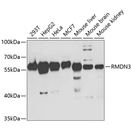Western Blot - Anti-PTPIP51 Antibody (A14995) - Antibodies.com