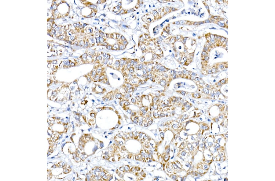 Immunohistochemistry - Anti-PTPIP51 Antibody (A14995) - Antibodies.com
