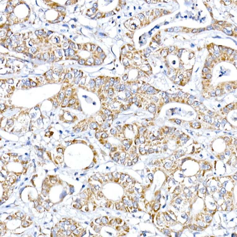 Immunohistochemistry - Anti-PTPIP51 Antibody (A14995) - Antibodies.com