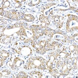Immunohistochemistry - Anti-PTPIP51 Antibody (A14995) - Antibodies.com