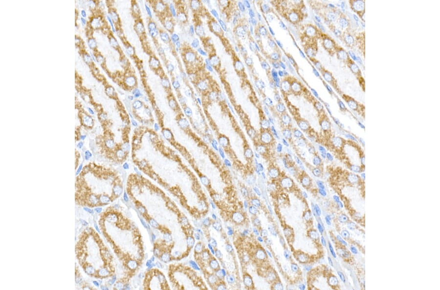 Immunohistochemistry - Anti-PTPIP51 Antibody (A14995) - Antibodies.com