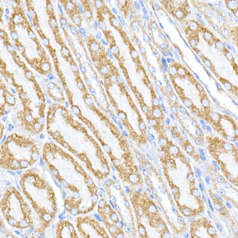 Immunohistochemistry - Anti-PTPIP51 Antibody (A14995) - Antibodies.com