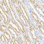 Immunohistochemistry - Anti-PTPIP51 Antibody (A14995) - Antibodies.com