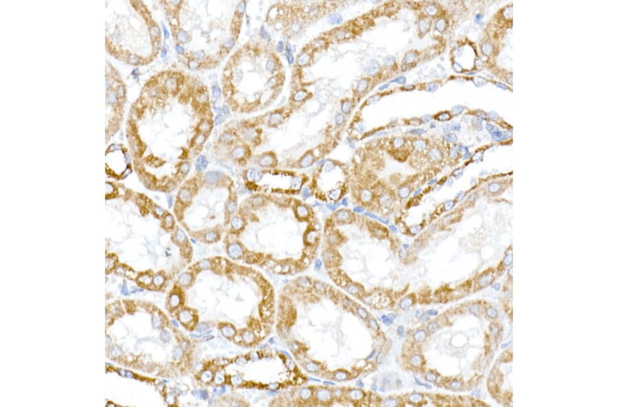 Immunohistochemistry - Anti-PTPIP51 Antibody (A14995) - Antibodies.com