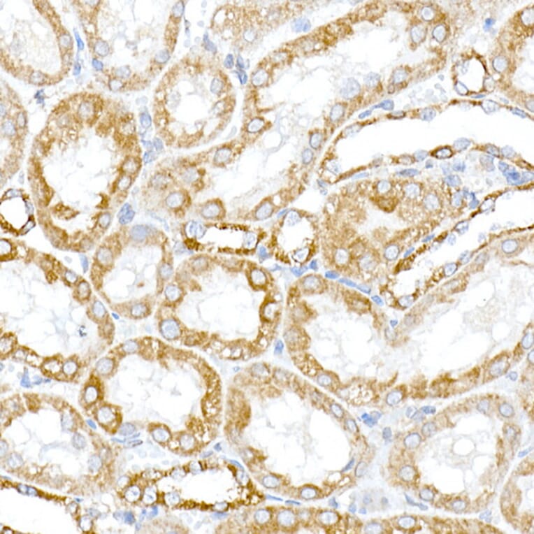 Immunohistochemistry - Anti-PTPIP51 Antibody (A14995) - Antibodies.com
