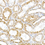 Immunohistochemistry - Anti-PTPIP51 Antibody (A14995) - Antibodies.com