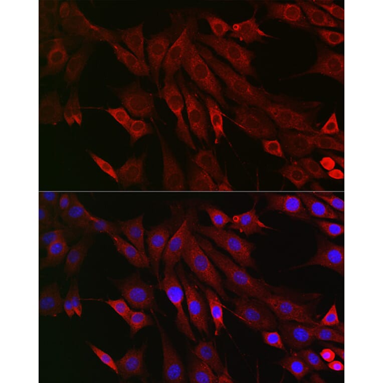 Immunofluorescence - Anti-PTPIP51 Antibody (A14995) - Antibodies.com
