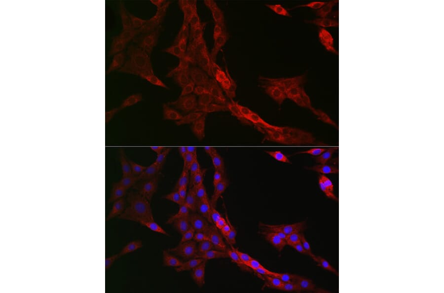 Immunofluorescence - Anti-PTPIP51 Antibody (A14995) - Antibodies.com