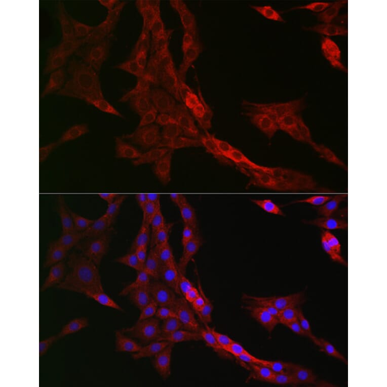 Immunofluorescence - Anti-PTPIP51 Antibody (A14995) - Antibodies.com
