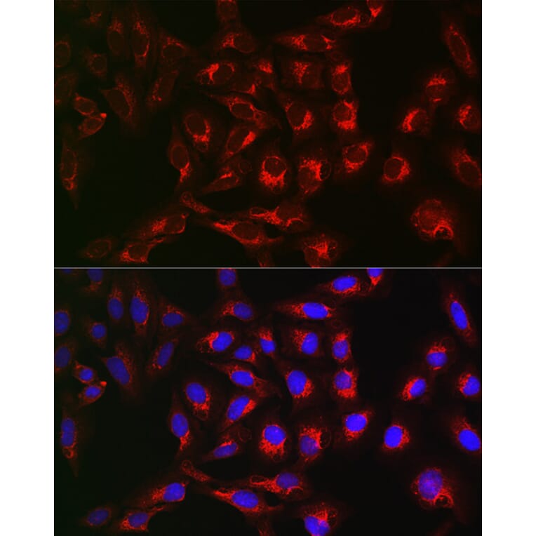 Immunofluorescence - Anti-PTPIP51 Antibody (A14995) - Antibodies.com