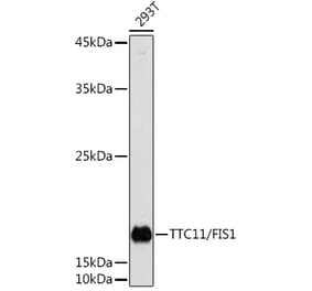 Western Blot - Anti-FIS1 Antibody (A14996) - Antibodies.com