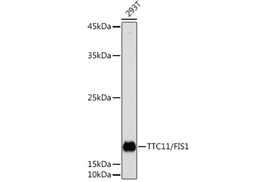 Western Blot - Anti-FIS1 Antibody (A14996) - Antibodies.com