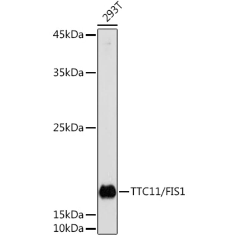 Western Blot - Anti-FIS1 Antibody (A14996) - Antibodies.com