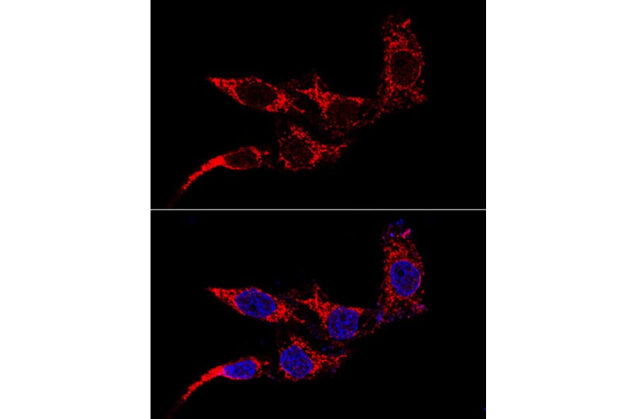 Immunofluorescence - Anti-FIS1 Antibody (A14996) - Antibodies.com