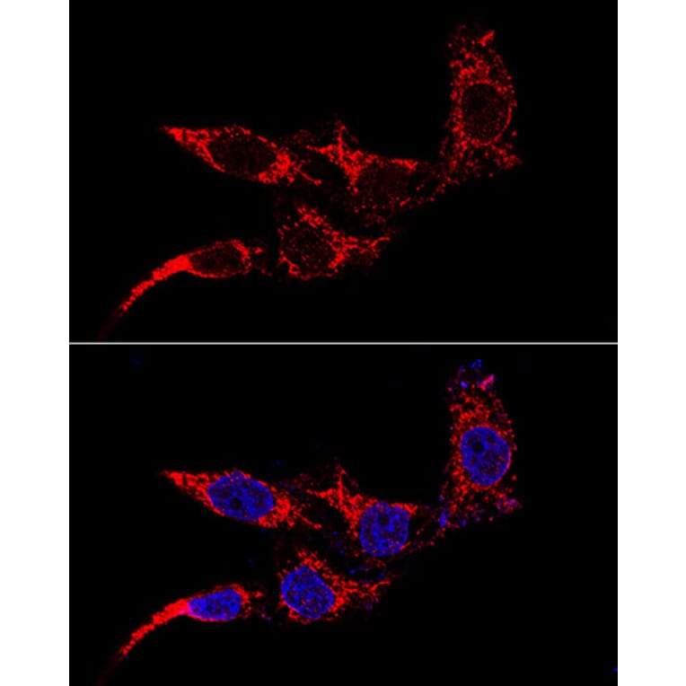 Immunofluorescence - Anti-FIS1 Antibody (A14996) - Antibodies.com