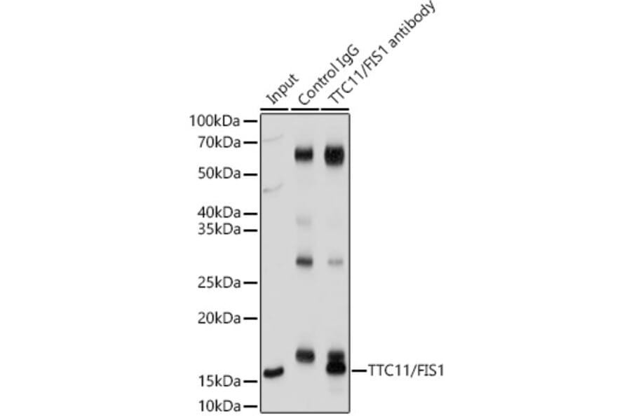 Immunoprecipitation - Anti-FIS1 Antibody (A14996) - Antibodies.com