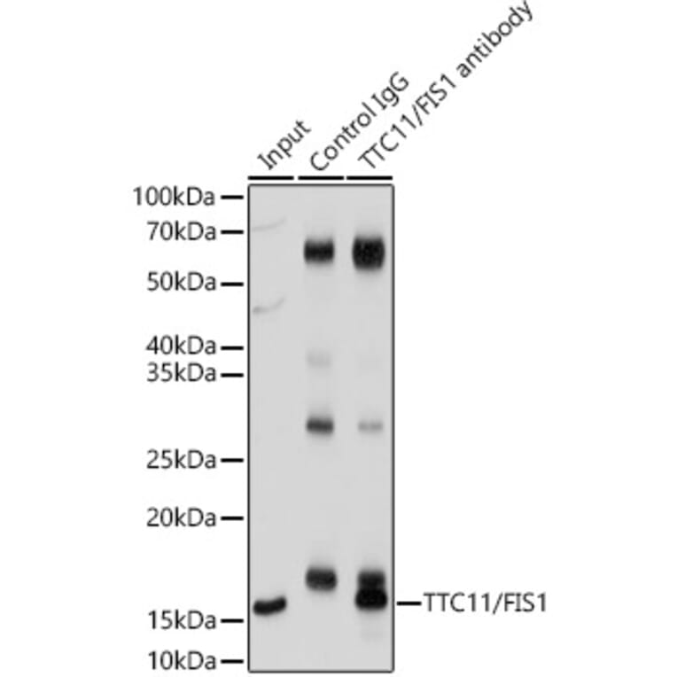Immunoprecipitation - Anti-FIS1 Antibody (A14996) - Antibodies.com