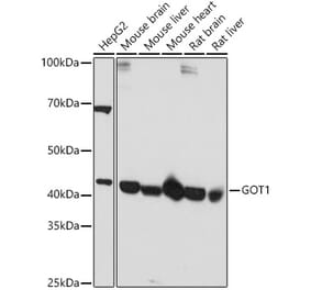 Western Blot - Anti-Aspartate Aminotransferase Antibody (A14997) - Antibodies.com