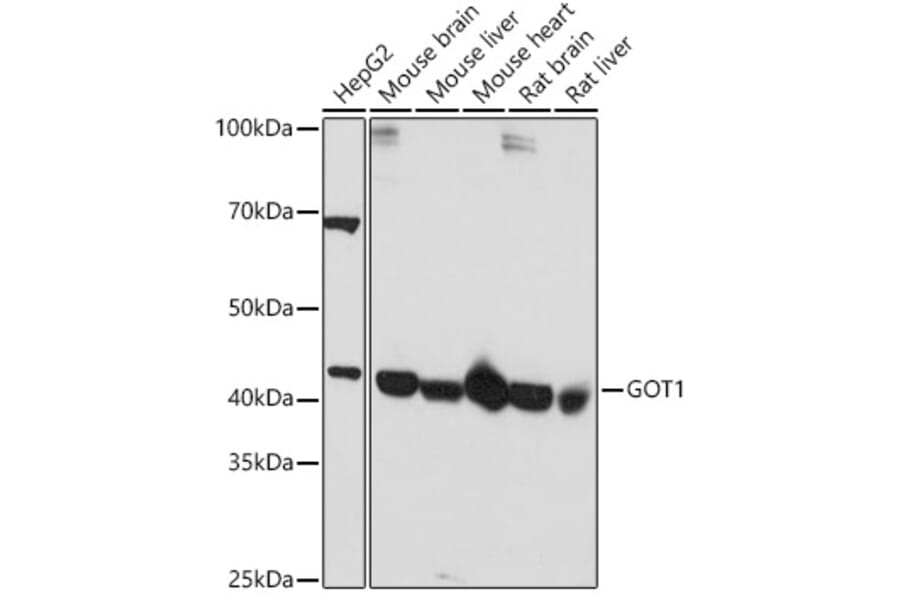 Western Blot - Anti-Aspartate Aminotransferase Antibody (A14997) - Antibodies.com