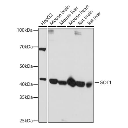 Western Blot - Anti-Aspartate Aminotransferase Antibody (A14997) - Antibodies.com