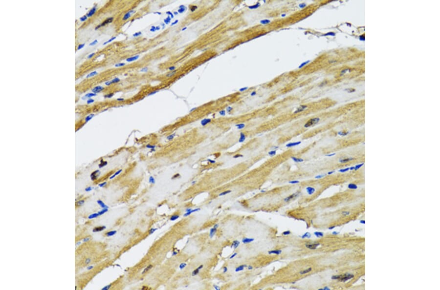 Immunohistochemistry - Anti-Aspartate Aminotransferase Antibody (A14997) - Antibodies.com