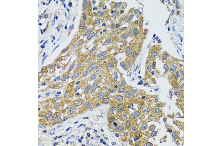 Immunohistochemistry - Anti-Aspartate Aminotransferase Antibody (A14997) - Antibodies.com