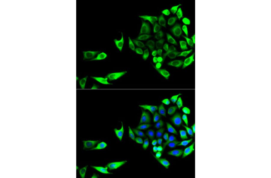 Immunofluorescence - Anti-Aspartate Aminotransferase Antibody (A14997) - Antibodies.com