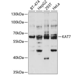 Western Blot - Anti-KAT7 / Hbo1 / MYST2 Antibody (A14998) - Antibodies.com