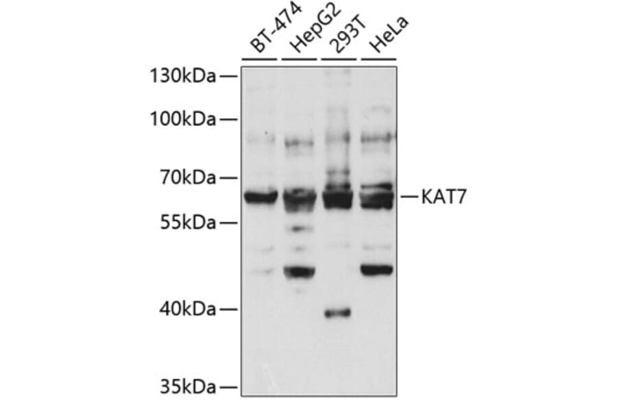 Western Blot - Anti-KAT7/Hbo1/MYST2 Antibody (A14998) - Antibodies.com