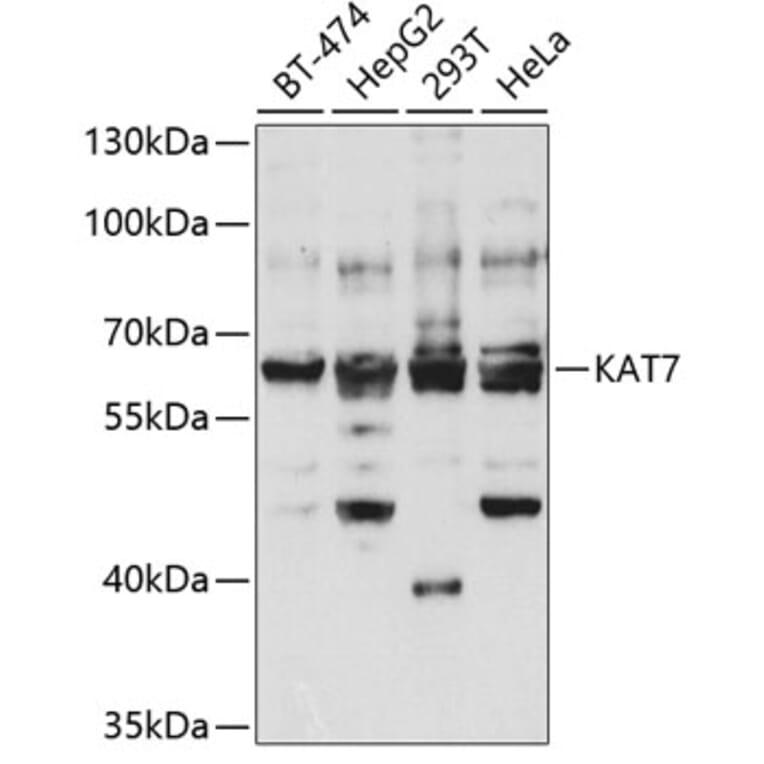 Western Blot - Anti-KAT7/Hbo1/MYST2 Antibody (A14998) - Antibodies.com