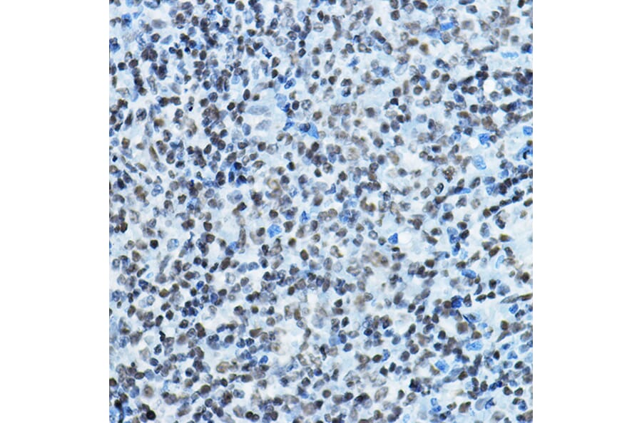Immunohistochemistry - Anti-KAT7/Hbo1/MYST2 Antibody (A14998) - Antibodies.com