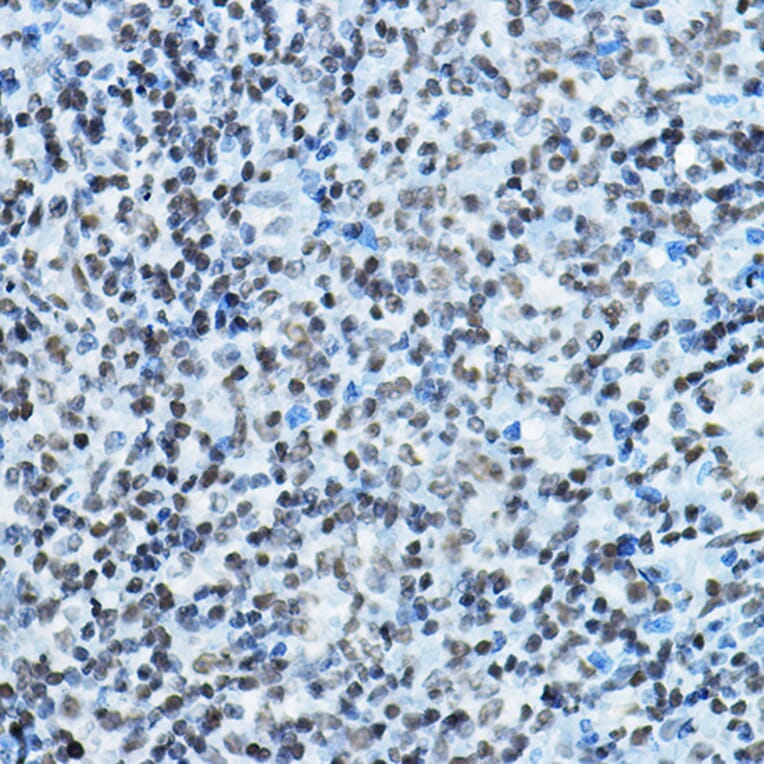 Immunohistochemistry - Anti-KAT7/Hbo1/MYST2 Antibody (A14998) - Antibodies.com