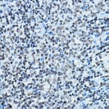 Immunohistochemistry - Anti-KAT7/Hbo1/MYST2 Antibody (A14998) - Antibodies.com