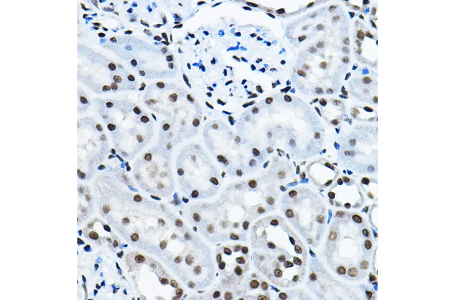 Immunohistochemistry - Anti-KAT7/Hbo1/MYST2 Antibody (A14998) - Antibodies.com