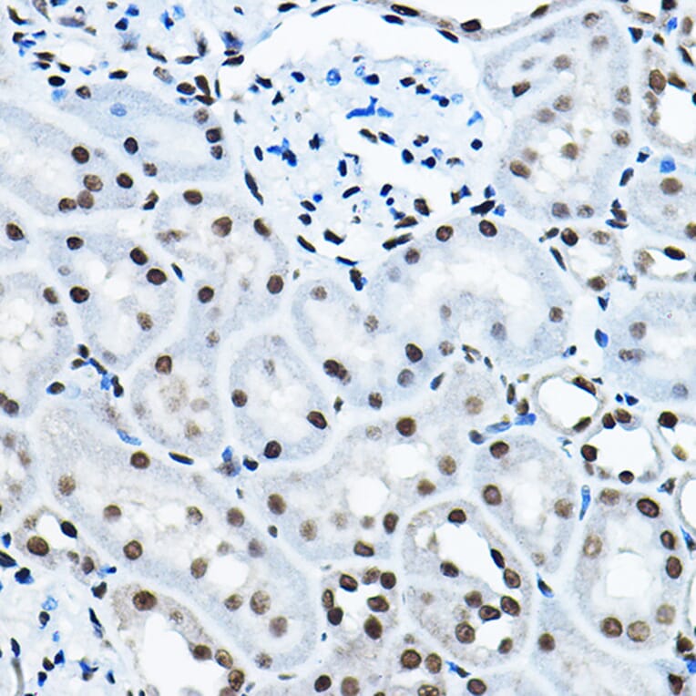Immunohistochemistry - Anti-KAT7/Hbo1/MYST2 Antibody (A14998) - Antibodies.com