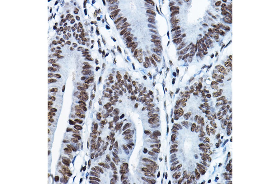Immunohistochemistry - Anti-KAT7/Hbo1/MYST2 Antibody (A14998) - Antibodies.com