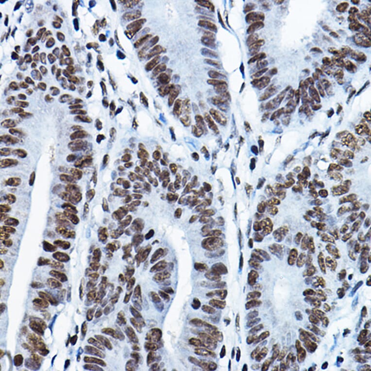 Immunohistochemistry - Anti-KAT7/Hbo1/MYST2 Antibody (A14998) - Antibodies.com