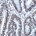 Immunohistochemistry - Anti-KAT7/Hbo1/MYST2 Antibody (A14998) - Antibodies.com
