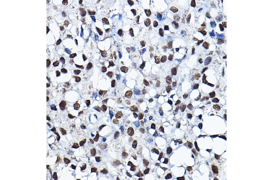 Immunohistochemistry - Anti-KAT7/Hbo1/MYST2 Antibody (A14998) - Antibodies.com