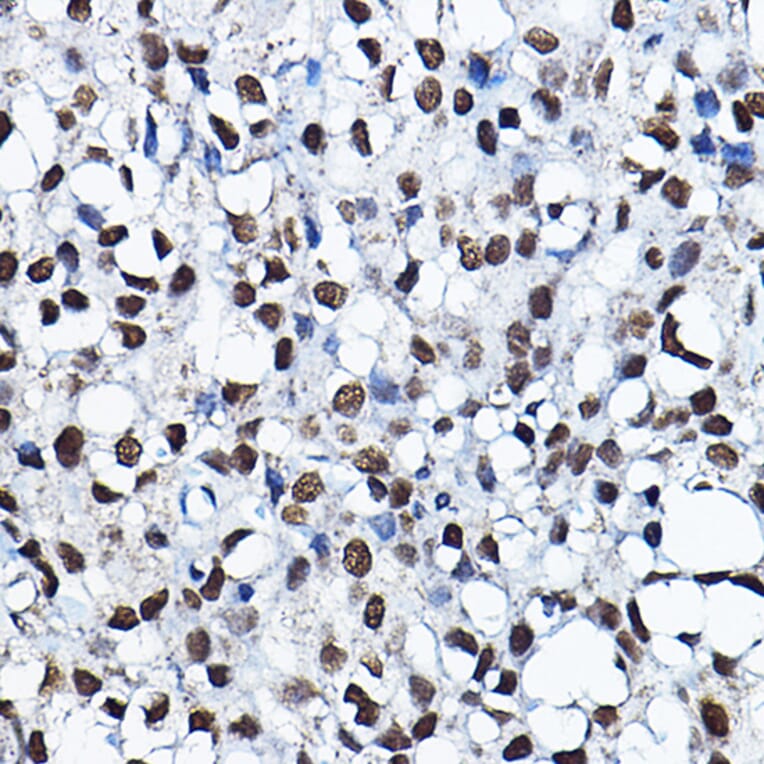 Immunohistochemistry - Anti-KAT7/Hbo1/MYST2 Antibody (A14998) - Antibodies.com
