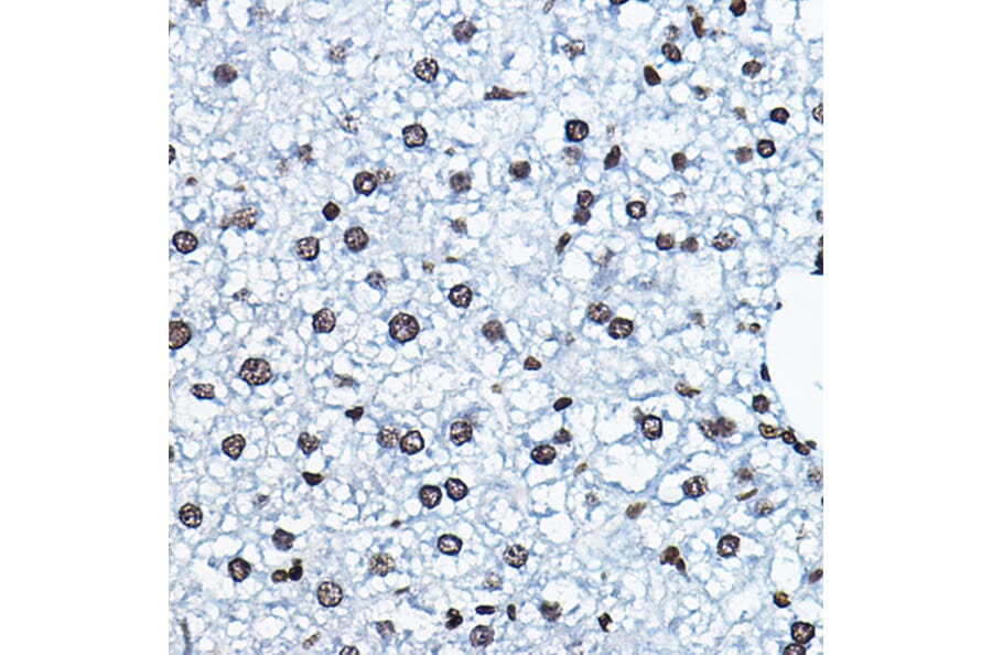 Immunohistochemistry - Anti-KAT7/Hbo1/MYST2 Antibody (A14998) - Antibodies.com