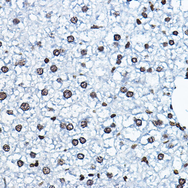 Immunohistochemistry - Anti-KAT7/Hbo1/MYST2 Antibody (A14998) - Antibodies.com