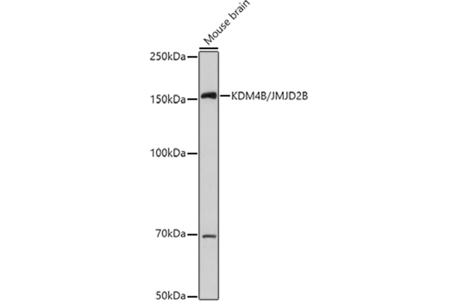 Western Blot - Anti-KDM4B/JMJD2B Antibody (A14999) - Antibodies.com